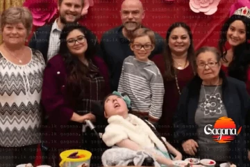 මොළයේ 90%ක් නැති තරුණියක් 20 වැනි උපන්දිනය සමරයි