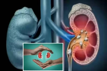 இந்த உணவுகள் எல்லாம் சிறுநீரக கற்களை கரைக்க உதவுமா?