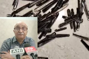பசி எடுத்தால் ஸ்பூன் சாப்பிடுவேன்! மருத்துவர்களை அலற விட்ட நபர்