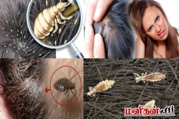 நம்ம தலையில் எப்படி பேன் வருதுன்னு தெரியுமா? வியக்க வைக்கும் உண்மைகள்!