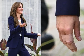 கையில் காயத்துடன் சிறைக்குச் சென்ற பிரித்தானிய இளவரசி கேட்: விவரம் செய்திக்குள்