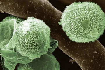 மிகுந்த பயங்கரமான பச்சை பூஞ்சை நோய் கண்டுபிடிப்பு! மருத்துவர்கள் எச்சரிக்கை