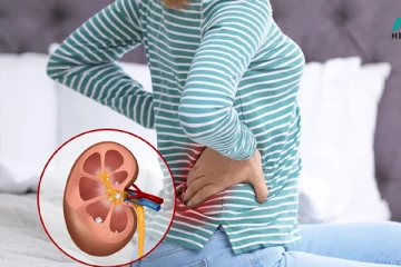 இந்த தவறுகளை செய்யாதீங்க... சிறுநீரக பிரச்சனை ஏற்படுமாம்