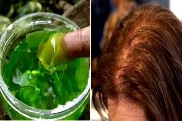 உச்சந்தலையில் அங்கங்க சொட்டை இருக்கா? அப்ப 'இந்த' டிப்ஸ் உங்களுக்கே