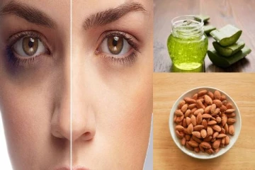 கண்ணை சுற்றி கருவளையமா! இதை மட்டும் செய்யுங்கள் உடனே நீங்கிவிடும்