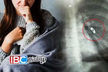 வெளிநாடான்றில் இருமலுக்காக வைத்தியசாலை சென்ற பெண்: காத்திருந்த பேரதிர்ச்சி