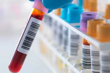 ஐரோப்பா முழுமையும் அடையாளம் காணப்பட்ட புதிய ஆபத்தான HIV தொற்று