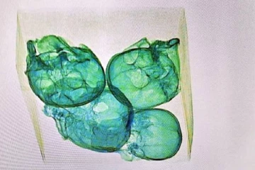 விமான நிலையத்தில் பரிசோதிக்கப்பட்ட பொதி: அதிகாரிகளுக்கு காத்திருந்த அதிர்ச்சி