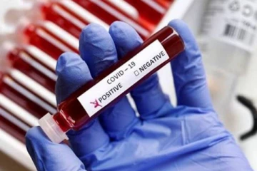 யாழில் ஆலய வாசலில் உயிரிழந்த பெண்ணுக்கும் கொரோனா!