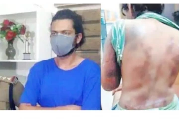 கண்ணில் மிளகாய் பொடி தூவி 22 நாட்களாக காதலியை கொடூரமாக துன்புறுத்திய சைக்கோ காதலன் கைது!