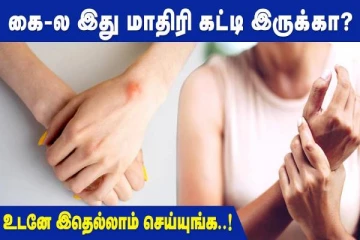 கையில இந்த மாதிரி கட்டி உருவாகிறதா? அலட்சியம் வேண்டாம் உடனே இதை செய்யுங்க!