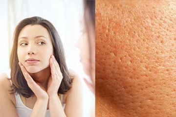 முகத்தில் உள்ள சரும துளைகளை போக்க வேண்டுமா? இதோ சில எளிய டிப்ஸ்