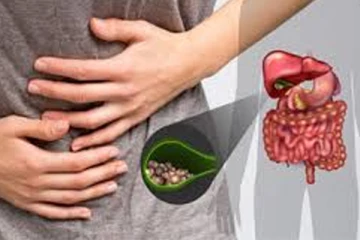 பித்தப்பை கற்களை 20 நாட்களில் வெளியேற்ற வேண்டுமா? இதோ சில ஆயுர்வேத வைத்திய முறைகள்!