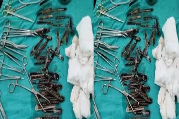 வயிற்றில் இருந்த 63 கரண்டிகளால் அதிர்ச்சியடைந்த மருத்துவர்கள்!