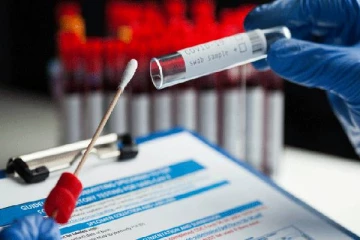 கோவிட் தொற்றுடன்  கோப்பாய் வைத்தியசாலையில் சேர்க்கப்பட்டுள்ள இந்தியர்கள்