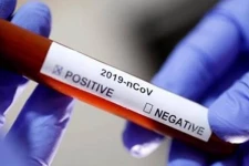 சிறைச்சாலைகளில் 4103 கொரோனா தொற்றாளர்கள்