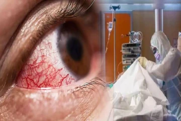 நாட்டின் பல பகுதிகளிலிருந்தும் கறுப்பு பூஞ்சை நோயுடன் கோவிட் தொற்றாளர்கள் அடையாளம்