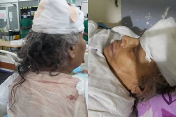 வயோதிப பெண்ணை தாக்கி நகைகள் திருட்டு:பொலிஸார் தீவிர விசாரணை(Photo)