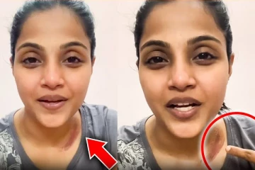 கார் விபத்தில் சிக்கிய சீரியல் நடிகை.. அது இருந்ததால் உயிர் தப்பினேன்