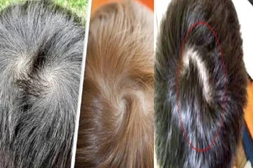 தலையில் இரட்டை சுழி இருந்தால் இதுதான் அர்த்தமா?