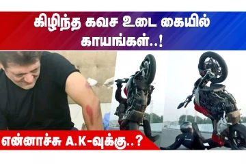 வலிமை படப்பிடிப்பில் நடிகர் அஜித்துக்கு காயம் - Shocking புகைப்படங்கள் வெளியீடு