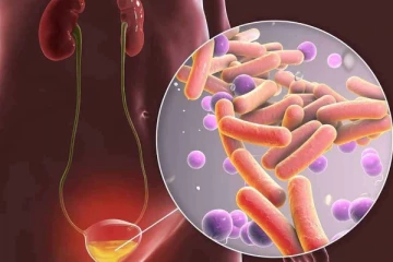 பெண்கள் - சிறுநீர்ப்பாதை தொற்றை தவிர்ப்பது எப்படி?