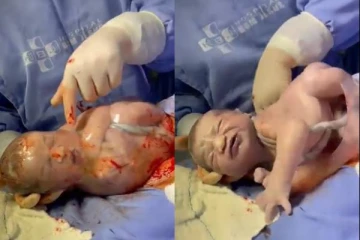 ஒரு நொடியில் பனிக்குடத்தில் வெளியேறும் குழந்தை... யாருக்கும் காணக்கிடைக்காத அபூர்வ காட்சி!