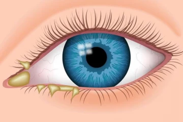 පණ වගේ රැක ගන්න ඇස් ලෙඩ වුණාම ඉඟි කරන ලක්ෂණ.