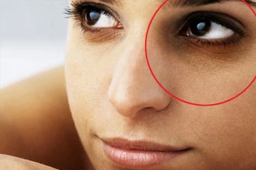 உங்களுக்கு கருவளையம் ரொம்ப இருக்கா? அதை போக்க இதனை பயன்படுத்தினாலே போதும்