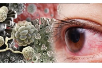 கருப்பு பூஞ்சை எவ்வாறு ஏற்படுகின்றது? மருத்துவர் அனிதா விஜயகுமார் கூறும் விளக்கம்!