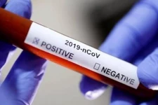 கொவிட் தடுப்பூசியை தருவிப்பது மிகவும் அவசியமானது! மருத்துவ நிபுணர்கள்