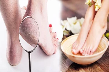 குளிர்காலத்தில் குதிகால் வெடிப்பால் அவதிப்படுகிறீர்களா? இதை ட்ரை பண்ணுங்க