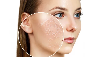 உங்களுக்கு வறண்ட சருமமா? இதற்கு  நிவாரணம் பெற இதோ சில டிப்ஸ்!