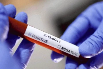 சென்னையில் அதிகரிக்கும் கொரோனா பாதிப்பு - விழிபிதுங்கும் தமிழக அரசு