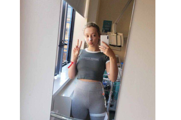 ஒரே ஒரு சாண்ட்விச் சாப்பிட்டதால் இளம்பெண் உயிருக்கு போராடும் அவலநிலை! நடந்தது என்ன? | Woman Allergic Everything Almost Killed