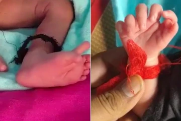 26 விரல்களுடன் பிறந்த அதிசய குழந்தை!