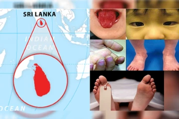 இலங்கைக்கு மற்றுமொரு ஆபத்து! உயிரிழப்பும் பதிவானது