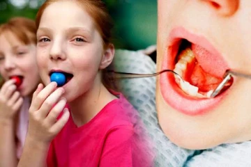 வாயிலிருக்கும் பற்களுக்கு வேட்டு வைக்கும் Chewing Gum! ஆபத்தில் சிக்கும் சிறுவர்கள்