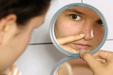 முகத்தில் அசிங்கமாக தெரியும் கரும்புள்ளியை நீக்க வேண்டுமா? சில எளிய வழிகள் இதோ