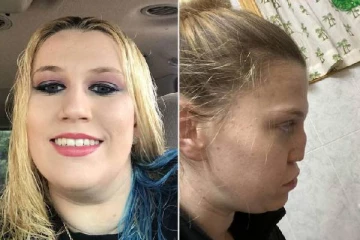 போதை பொருளுக்கு அடிமையான பெண்..மூக்கில் ஓட்டை விழுந்த சம்பவம் - பகீர் பின்னணி!