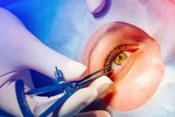 கண் சத்திர சிகிச்சை விவகாரம் ; 300 மில்லியன் ரூபா நஷ்ட ஈடு கோரும் மூன்று நோயாளிகள்