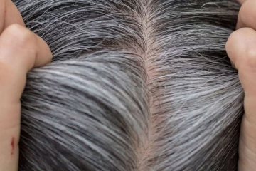 நரைமுடிக்கு தீர்வு வேண்டுமா? வீட்டில் இருக்கும் இந்த பொருட்களே போதும்!