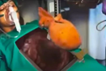 வெறும் 2 நிமிடத்தில் இதய மாற்று அறுவை சிகிச்சை! வயிறு குலுங்க சிரிக்கலாம்…ட்ரெண்டிங் வீடியோ