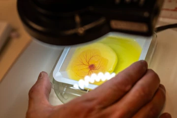 இளம் புற்றுநோயால் பாதிக்கப்பட்டவர்களுக்கு புதிய சிகிச்சை ; கனடா ஆய்வாளர்கள் கண்டு பிடிப்பு