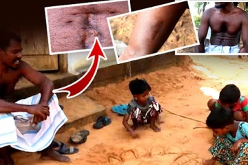 இறுதி யுத்தத்தில் இரு தடவை காயமடைந்து வாழும் ஒரு தந்தையின் அவலம்