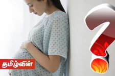 இலங்கையில் தாய்மார் இறப்பு விகிதத்தில் சடுதியாக ஏற்பட்ட உயர்வு