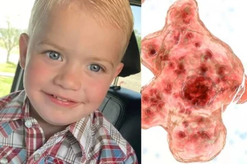 வெறும் காய்ச்சல் அறிகுறி தான்... மூளையை சேதப்படுத்தும் கிருமியால் மரணமடைந்த சிறுவன்