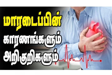 மாரடைப்பு  வருவதற்கான அறிகுறிகள்... தடுக்கும் வழிமுறைகளும்! கட்டாயம் இதை ஃபலோ பண்ணுங்க