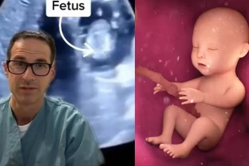 இளம்பெண்ணின் கல்லீரலில் வளர்ந்த கரு!! நம்ப முடியாத உண்மை சம்பவம்