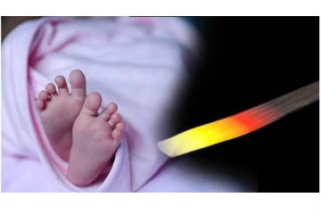 இரும்பு கம்பியால் 24 முறை சூடு வைத்ததால் 3 மாத பெண் குழந்தை உயிரிழப்பு...! - அதிர்ச்சி சம்பவம்...!